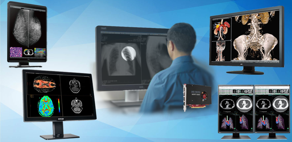 PACS system for radiology