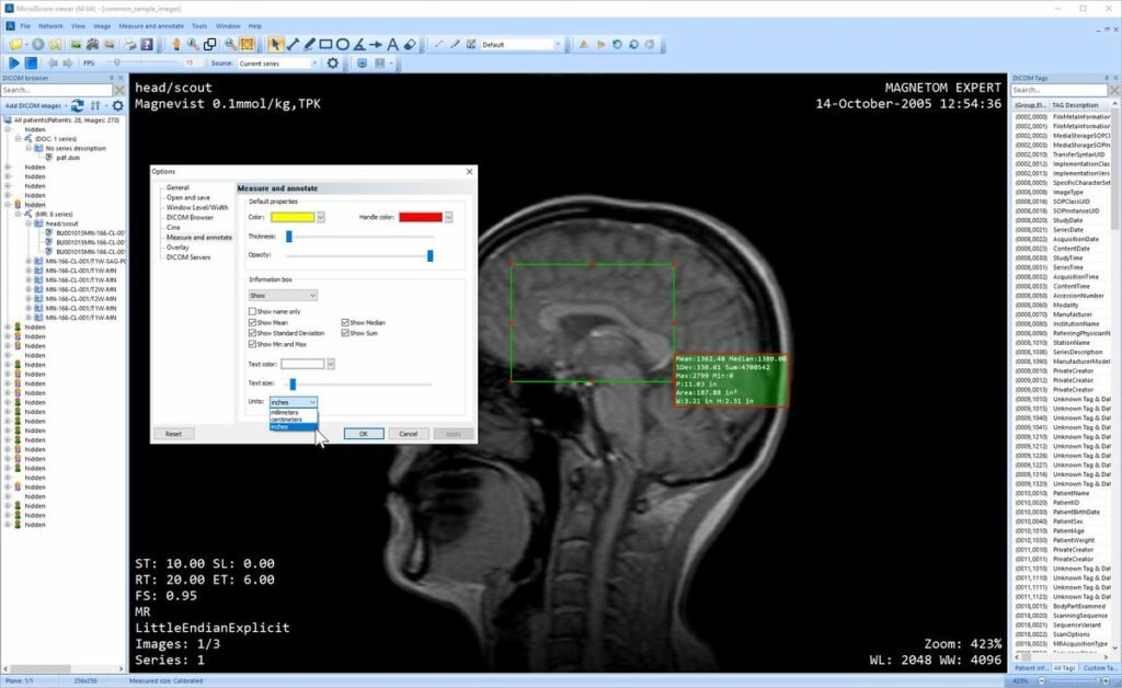 MicroDICOM installer