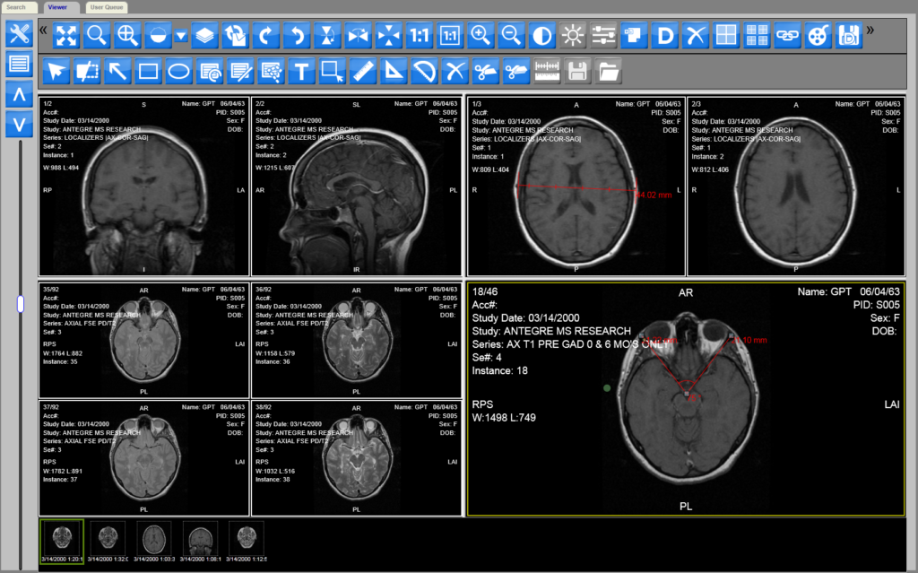 image DICOM viewer online