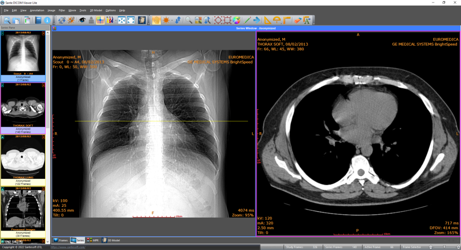 image DICOM viewer online