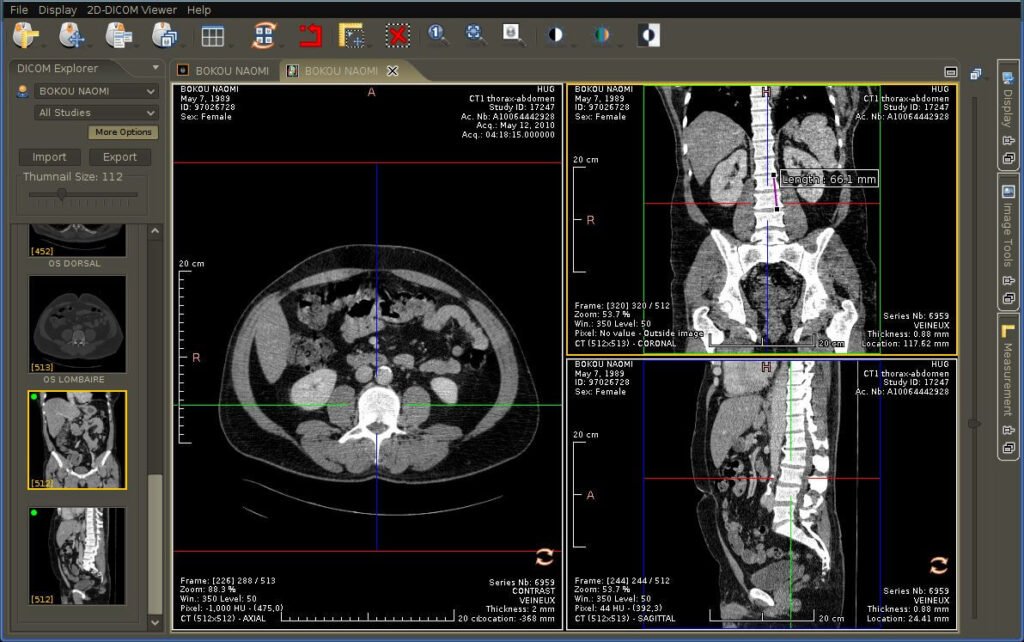 dicom viewer web