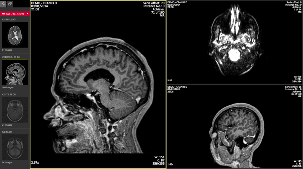 HTML5 DICOM viewer